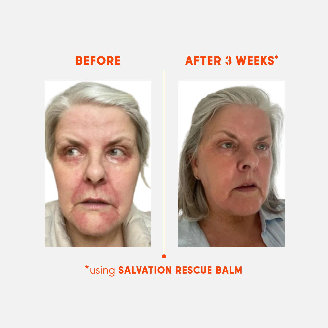 SALVATION. Rescue Balm - Image 5